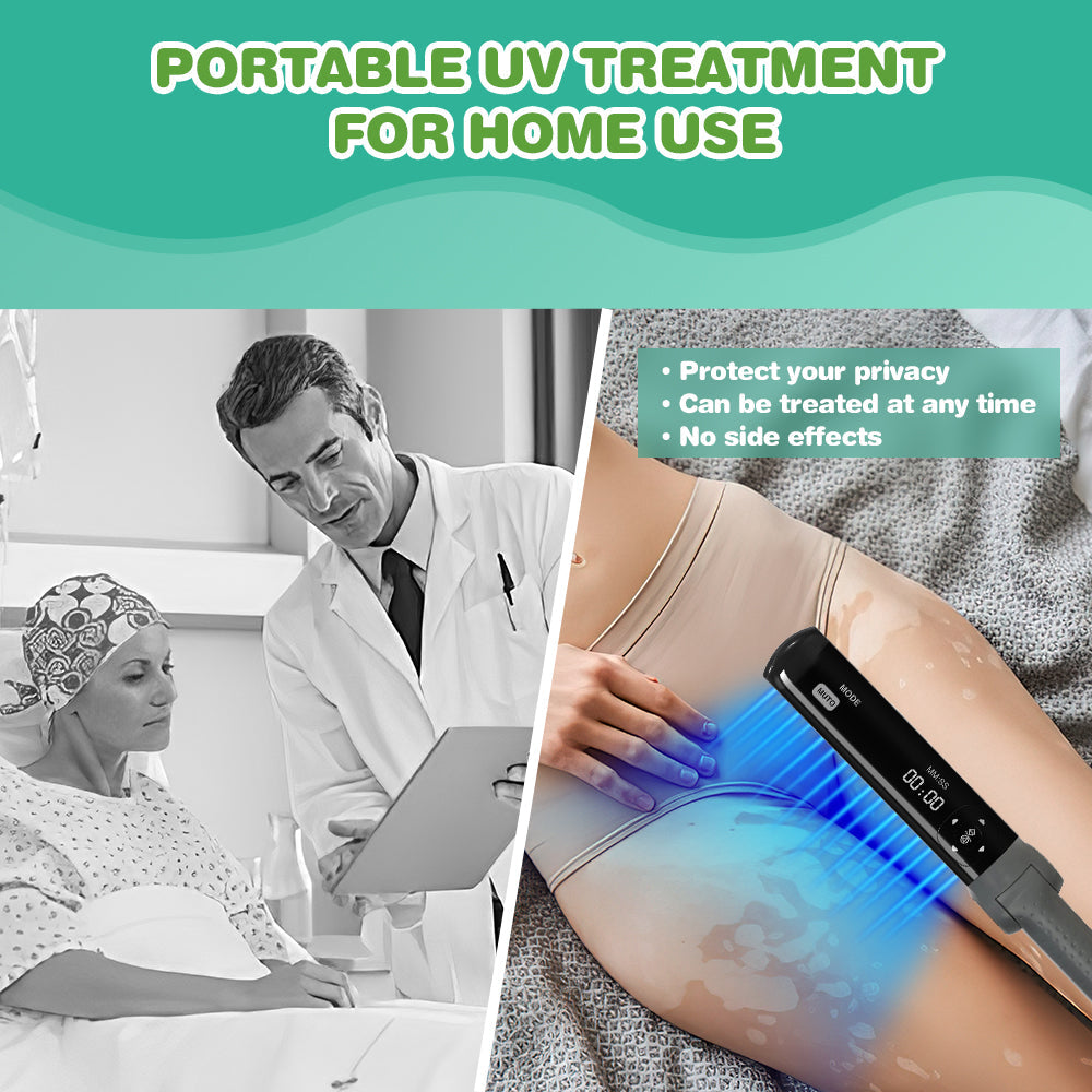 Terapia de Luz UVB 311nm para Psoríase e Vitiligo