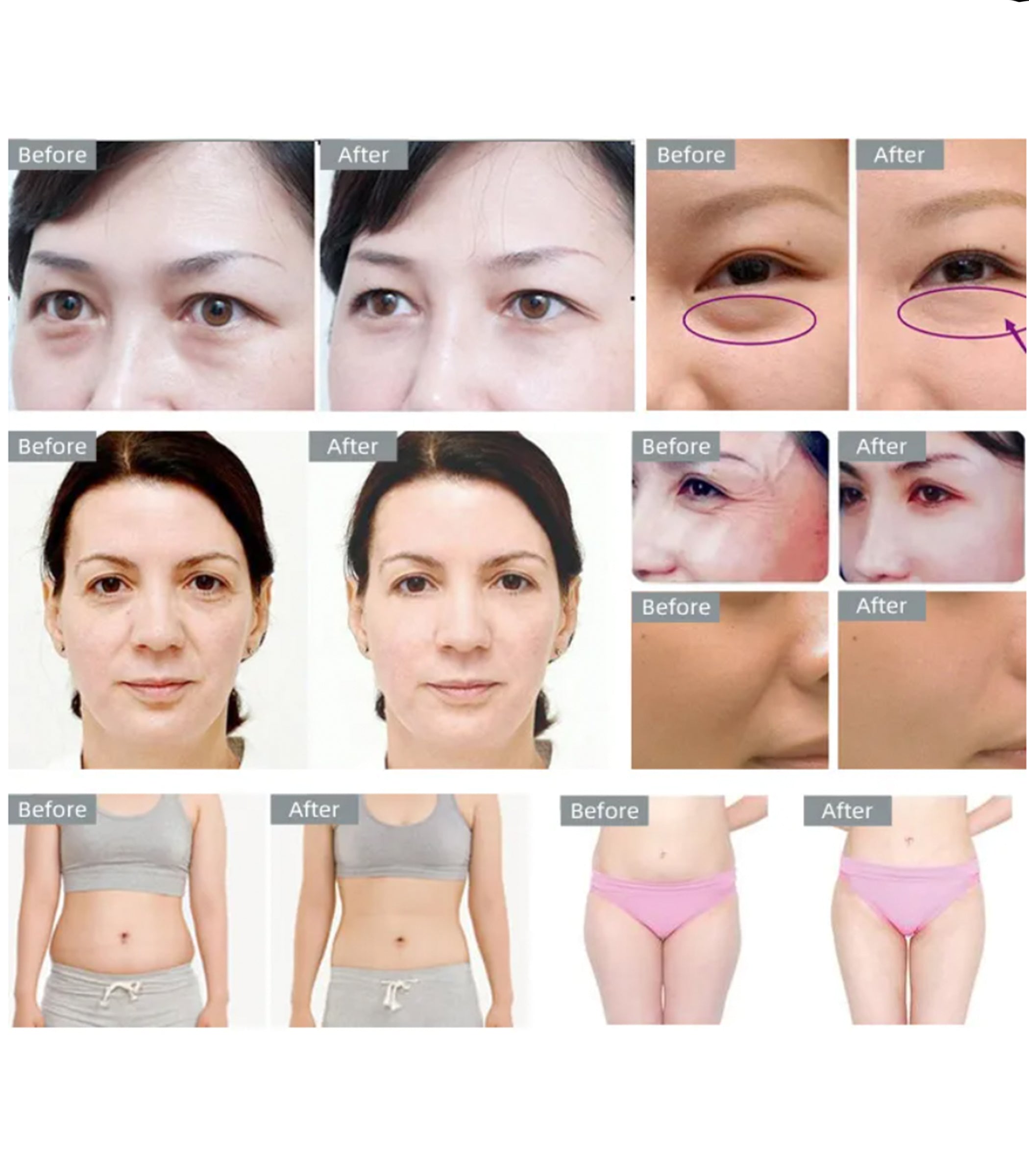 40 kHz Kavitation Körper-Straffungsgerät für den Heimgebrauch