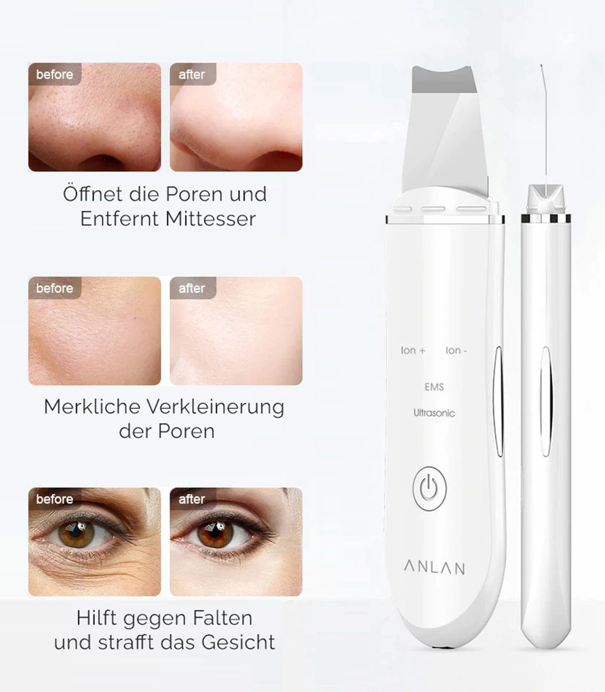 Ultraääninen ioni-ihohoitolaite kotikäyttöön kasvojen puhdistukseen