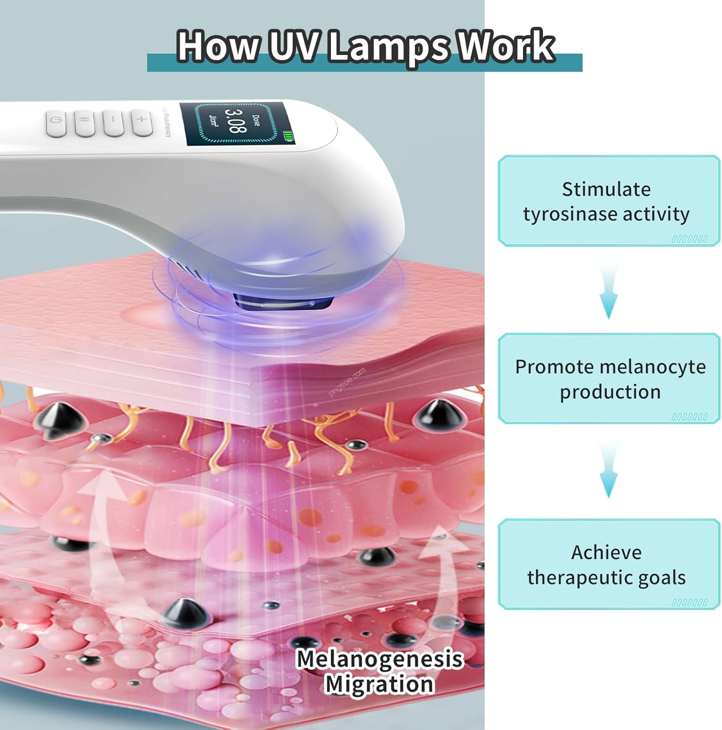 308nm UV-licht fototherapie LED-lamp voor thuisgebruik model
