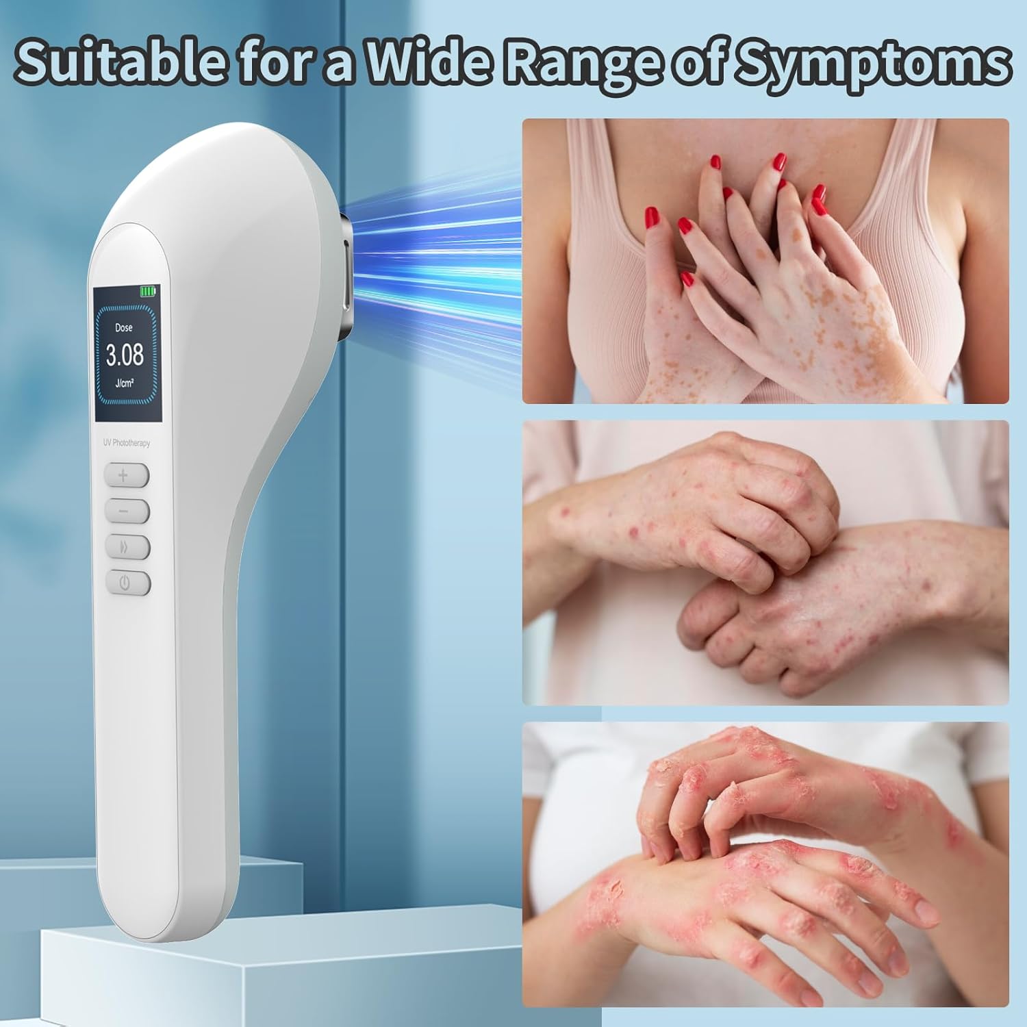 308nm UV-lys fototerapilampe med LED til hjemmebrug model