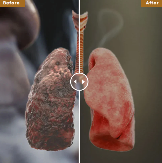 Aurelia Mullein Lung Support Spray For Clear Breathing