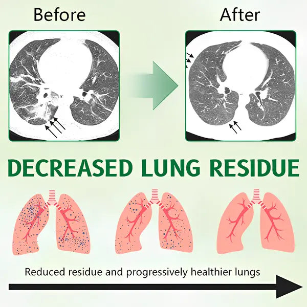 Aurelia Mullein Lung Support Spray For Clear Breathing