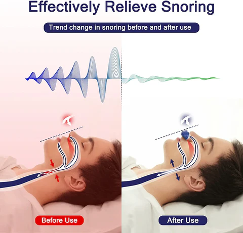 Travel Friendly Micro CPAP Device For Sleep Apnea And Snoring Relief