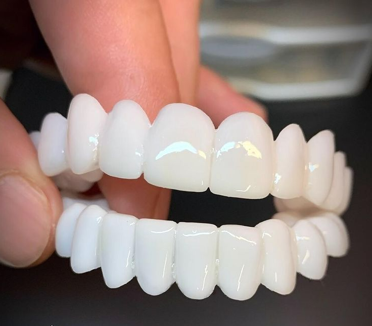 Dental Prosthesis For Confident Smiles And Daily Comfort
