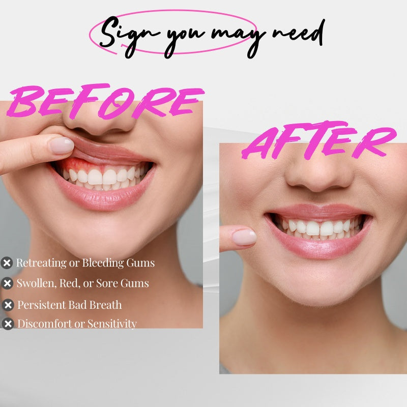 Red Light Therapy For Gums | Svulp